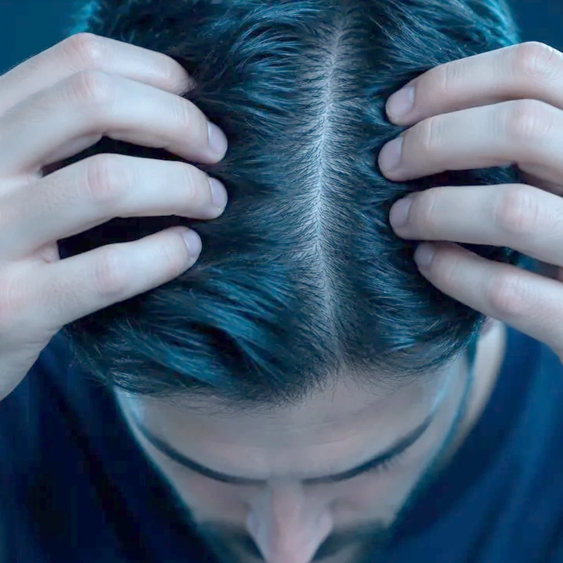 Fingertips parting the hair to expose the scalp