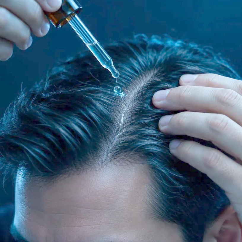 Dropper releasing solution directly onto the scalp